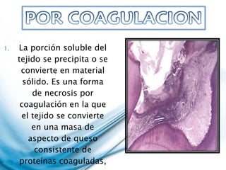 La porción soluble del tejido se precipita o se convierte en material sólido. Es una forma de necrosis por coagulación en la que el tejido se convierte en una masa de aspecto de queso consistente de proteínas coaguladas, grasas y agua.  