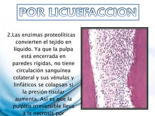 2.Las enzimas proteolíticas convierten el tejido en líquido. Ya que la pulpa está encerrada en paredes rígidas, no tiene circulación sanguínea colateral y sus vénulas y linfáticos se colapsan si la presión tisular aumenta. Así es que la pulpitis irreversible lleva a la necrosis por licuefacción.  