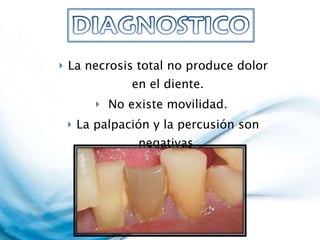La necrosis total no produce dolor en el diente. No existe movilidad.  La palpación y la percusión son negativas  