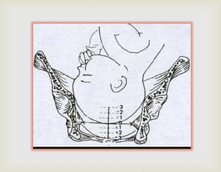 pelvis_pelvimetria_planos