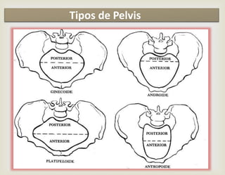 Tipos de Pelvis
 