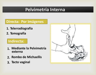 1.
2.
Telerradiografía
Tomografía
1.
2.
3.
Mediante la Pelvimetría
Rombo de Michaellis
Tacto vaginal
externa
Indirecta:
Directa: Por Imágenes
Pelvimetría Interna
 