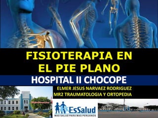 HOSPITAL II CHOCOPE
FISIOTERAPIA EN
EL PIE PLANO
ELMER JESUS NARVAEZ RODRIGUEZ
MR2 TRAUMATOLOGIA Y ORTOPEDIA
 