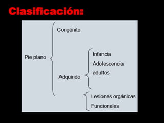 Clasificación:
 