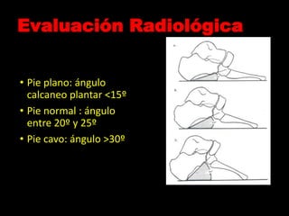 Evaluación Radiológica
• Pie plano: ángulo
calcaneo plantar <15º
• Pie normal : ángulo
entre 20º y 25º
• Pie cavo: ángulo >30º
 