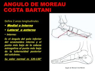 ANGULO DE MOREAU
COSTA BARTANI
Define 2 arcos longitudinales
 Medial o interno
 Lateral o externo
• Interno:
Es el ángulo del polo inferior
del sesamoideo interno y el
punto más bajo de la cabeza
astragalina al punto más bajo
de la tuberosidad posterior
del calcáneo.
Su valor normal es 120-130°
 