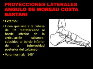 PROYECCIONES LATERALES
ANGULO DE MOREAU COSTA
BARTANI
• Externo:
• Línea que une a la cabeza
del 5º. metatarsiano al
borde inferior de la
articulación calcaneo-
cuboidea al borde inferior
de la tuberosidad
posterior del calcáneo.
• Valor normal: 145°
 