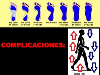 COMPLICACIONES:
 
