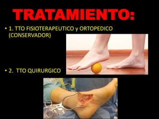 TRATAMIENTO:
• 1. TTO FISIOTERAPEUTICO y ORTOPEDICO
(CONSERVADOR)
• 2. TTO QUIRURGICO
 