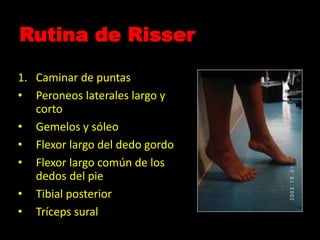 Rutina de Risser
1. Caminar de puntas
• Peroneos laterales largo y
corto
• Gemelos y sóleo
• Flexor largo del dedo gordo
• Flexor largo común de los
dedos del pie
• Tibial posterior
• Tríceps sural
 