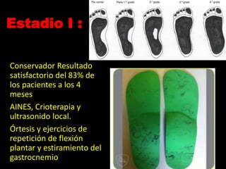 Estadio I :
Conservador Resultado
satisfactorio del 83% de
los pacientes a los 4
meses
AINES, Crioterapia y
ultrasonido local.
Órtesis y ejercicios de
repetición de flexión
plantar y estiramiento del
gastrocnemio
 