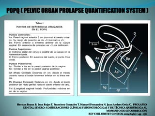 Hernan Braun B. Ivan Rojas T. Francisco Gonzales T. Manuel Fernandez N. Juan Andres Ortiz C. PROLAPSO
GENITAL SEVERO: COSIDERACIONES CLÍNICAS FISIOPATOLÓGICAS Y DE TÉCNICA QUIRÚRGICA AL
MOMENTO DE SU CORRECCIÓN
REV CHIL OBSTET GINECOL 2004:69(2): 149 - 156
POPQ ( PELVIC ORGAN PROLAPSE QUANTIFICATION SYSTEM )
 