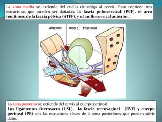 La zona media se extiende del cuello de vejiga al cervix. Esto contiene tres
estructuras que pueden ser dañadas: la fascia pubocervical (PCF), el arco
tendinoso de la fascia pélvica (ATFP), y el anillo cervical anterior .
La zona posterior se extiende del cervix al cuerpo perineal .
Los ligamentos úterosacro (USL), la fascia rectovaginal (RVF) y cuerpo
perineal (PB) son las estructuras claves de la zona posteriores que pueden sufrir
daño.
 
