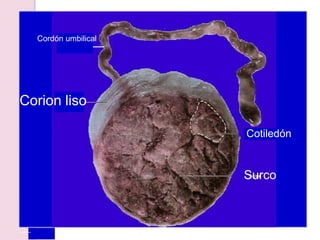Cotiledón
Cordón umbilical
Corion liso
Surco
 