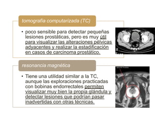 Tc Poco Element EXPO PROSTATA.pptx