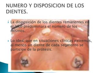  La disposición de los dientes remanentes en
el arco predominara el número de los
mismos.
 Lo ideal que en situaciones clínicas extremas,
al menos un diente de cada segmento se
participe de la prótesis.
 