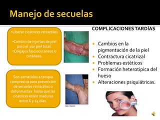 COMPLICACIONES TARDÍAS
•Liberar cicatrices retractiles
               .
 •Cambio de injertos de piel
    parcial por piel total.
                                     Cambios en la
 •Colgajos fasciocutaneos o           pigmentación de la piel
          cutáneos.                  Contractura cicatrizal
                                     Problemas estéticos
                                     Formación heterotipica del
  Son sometidos a terapia             hueso
compresiva para prevención           Alteraciones psiquiátricas.
  de secuelas retractiles o
 deformantes hasta que las
  cicatrices estén maduras
      entre 6 y 24 días.
 