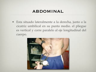 abdominal
• Esta situado lateralmente a la derecha, junto a la
  cicatriz umbilical en su punto medio. el pliegue
  es vertical y corre paralelo al eje longitudinal del
  cuerpo.
 