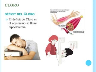 CLORO
DÉFICIT DEL CLORO
 El déficit de Cloro en
el organismo se llama
hipocloremia
 