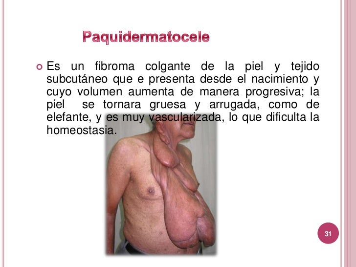 Que crema de la farmacia aumentará el miembro