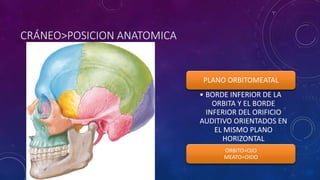 CRÁNEO>POSICION ANATOMICA
PLANO ORBITOMEATAL
• BORDE INFERIOR DE LA
ORBITA Y EL BORDE
INFERIOR DEL ORIFICIO
AUDITIVO ORIENTADOS EN
EL MISMO PLANO
HORIZONTAL
ORBITO=OJO
MEATO=OIDO
 