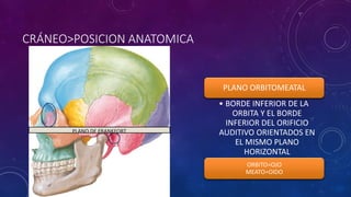 CRÁNEO>POSICION ANATOMICA
PLANO ORBITOMEATAL
• BORDE INFERIOR DE LA
ORBITA Y EL BORDE
INFERIOR DEL ORIFICIO
AUDITIVO ORIENTADOS EN
EL MISMO PLANO
HORIZONTAL
ORBITO=OJO
MEATO=OIDO
PLANO DE FRANKFORT
 