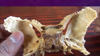 CRANEO> ESFENOIDES> POSTERIOR
 