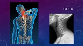 CUELLO
 