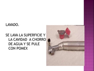 LAVADO.
SE LAVA LA SUPERFICIE Y
LA CAVIDAD A CHORRO
DE AGUA Y SE PULE
CON POMEX
 