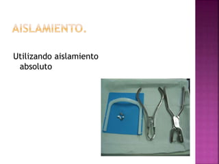 Utilizando aislamiento
absoluto
 