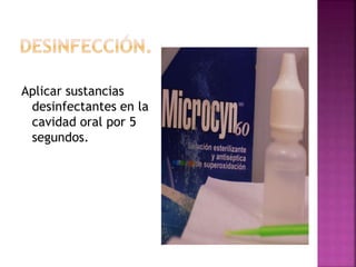 Aplicar sustancias
desinfectantes en la
cavidad oral por 5
segundos.
 