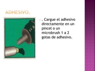 . Cargue el adhesivo
directamente en un
pincel o un
microbrush 1 a 2
gotas de adhesivo.
 