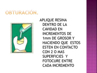 APLIQUE RESINA
DENTRO DE LA
CAVIDAD EN
INCREMENTOS DE
1mm DE GROSOR Y
HACIENDO QUE ESTOS
ESTEN EN CONTACTO
CON 2 O MAS
SUPERFICIES Y
FOTOCURE ENTRE
CADA INCREMENTO
 