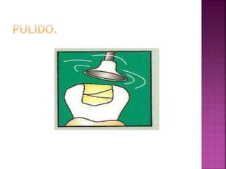 Resinas operatoria dental