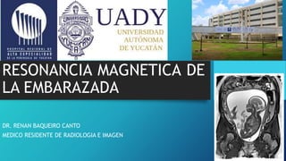 RESONANCIA MAGNETICA DE
LA EMBARAZADA
DR. RENAN BAQUEIRO CANTO
MEDICO RESIDENTE DE RADIOLOGIA E IMAGEN
 