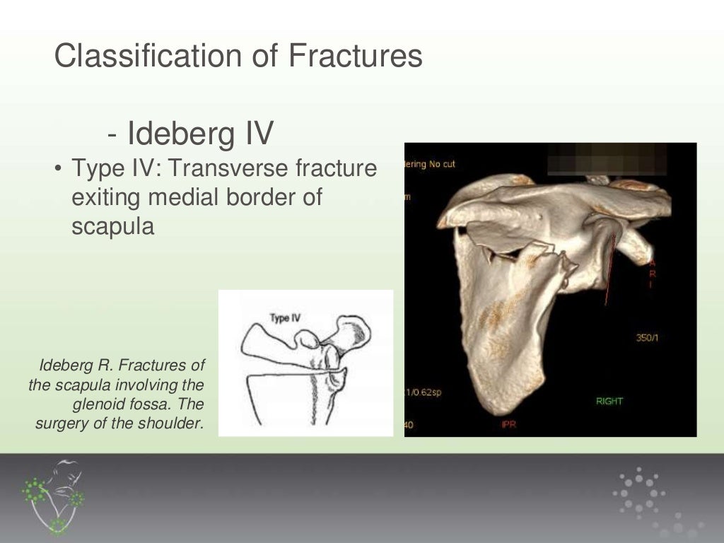 Scapula Fractures