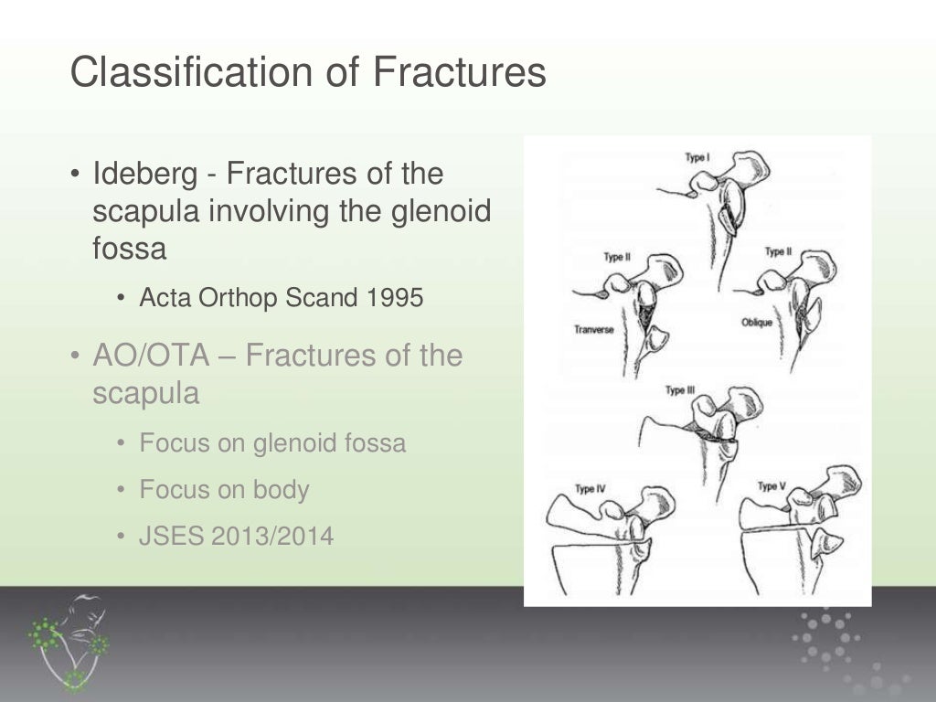 Scapula Fractures