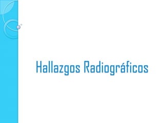 Hallazgos Radiográficos
 