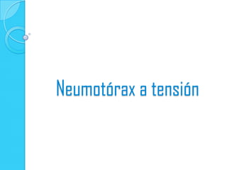 Neumotórax a tensión
 