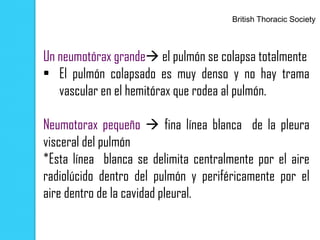 British Thoracic Society



Un neumotórax grande el pulmón se colapsa totalmente
• El pulmón colapsado es muy denso y no hay trama
   vascular en el hemitórax que rodea al pulmón.

Neumotorax pequeño  fina línea blanca de la pleura
visceral del pulmón
*Esta línea blanca se delimita centralmente por el aire
radiolúcido dentro del pulmón y periféricamente por el
aire dentro de la cavidad pleural.
 