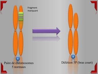 Fragment
               manquant




                                  B
        A
Paire de chromosomes      Délétion 5P (bras court)
      5 normaux
 