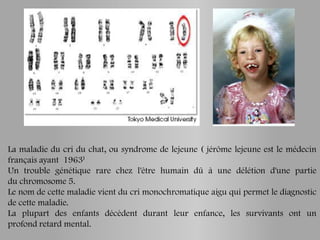 La maladie du cri du chat, ou syndrome de lejeune ( jérôme lejeune est le médecin
français ayant 1963)
Un trouble génétique rare chez l'être humain dû à une délétion d'une partie
du chromosome 5.
Le nom de cette maladie vient du cri monochromatique aigu qui permet le diagnostic
de cette maladie.
La plupart des enfants décèdent durant leur enfance, les survivants ont un
profond retard mental.
 