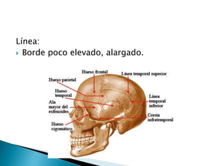 Línea:
 Borde poco elevado, alargado.
 