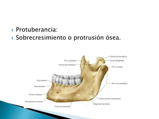  Protuberancia:
 Sobrecresimiento o protrusión ósea.
 