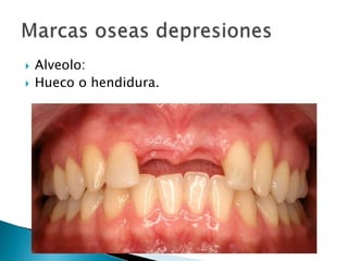  Alveolo:
 Hueco o hendidura.
 