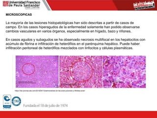 MICROSCOPICAS
La mayoría de las lesiones histopatológicas han sido descritas a partir de casos de
campo. En los casos hiperagudos de la enfermedad solamente han podido observarse
cambios vasculares en varios órganos, especialmente en hígado, bazo y riñones.
En casos agudos y subagudos se ha observado necrosis multifocal en los hepatocitos con
acúmulo de fibrina e infiltración de heterófilos en el parénquima hepático. Puede haber
infiltración peritoneal de heterófilos mezclados con linfocitos y células plasmáticas.
https://las-plumas-ala.com/2019/04/13/salmonelosis-en-las-aves-pulorosis-y-tifoidea-aviar/
 