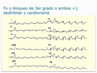 Fv o bloqueo de 3er grado o ambos =),
desfribilar y cardiovierte
 