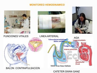 MONITOREO HEMODINAMICO
FUNCIONES VITALES
CATETER SWAN GANZ
LINEA ARTERIAL
AGA
BALON CONTRAPULSACION
 