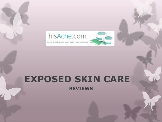exposed-skin-care-reviews
