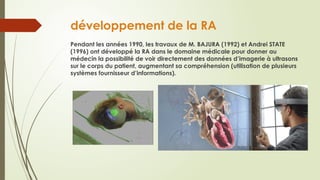 développement de la RA
Pendant les années 1990, les travaux de M. BAJURA (1992) et Andrei STATE
(1996) ont développé la RA dans le domaine médicale pour donner au
médecin la possibilité de voir directement des données d’imagerie à ultrasons
sur le corps du patient, augmentant sa compréhension (utilisation de plusieurs
systèmes fournisseur d’informations).
 